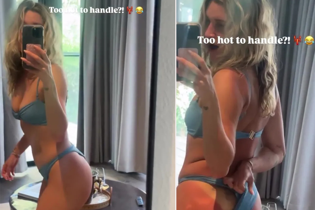 Ashley Roberts, Türkiye tatilinde güneşin bedelini esprili sözlerle anlattı