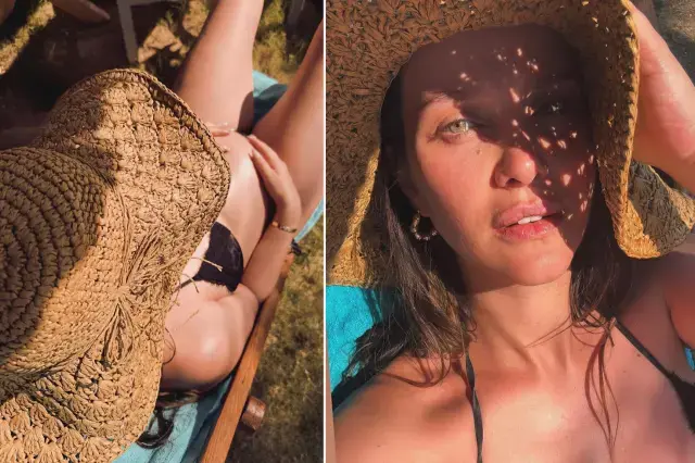 İrem Helvacıoğlu tatilde kaza geçirdi: Felç kaldım sandım