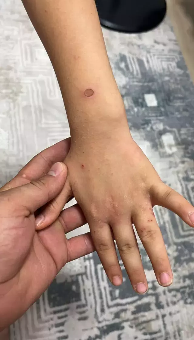 'Sular şehri' Kahramanmaraş'ta 20 gündür bir damla su akmıyor, hastalıklar başladı