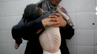 Soykırımcı İsrail’in kıtlığı dayattığı Gazze’de 2 Filistinli daha açlıktan hayatını kaybetti