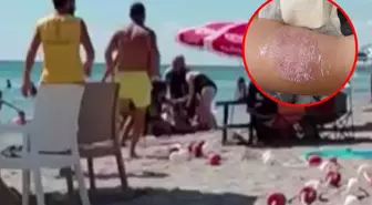 Plaj keyfi ‘sigara dumanı’ ile kabusa döndü, üst üste dövüşüp kolunu ısırdı